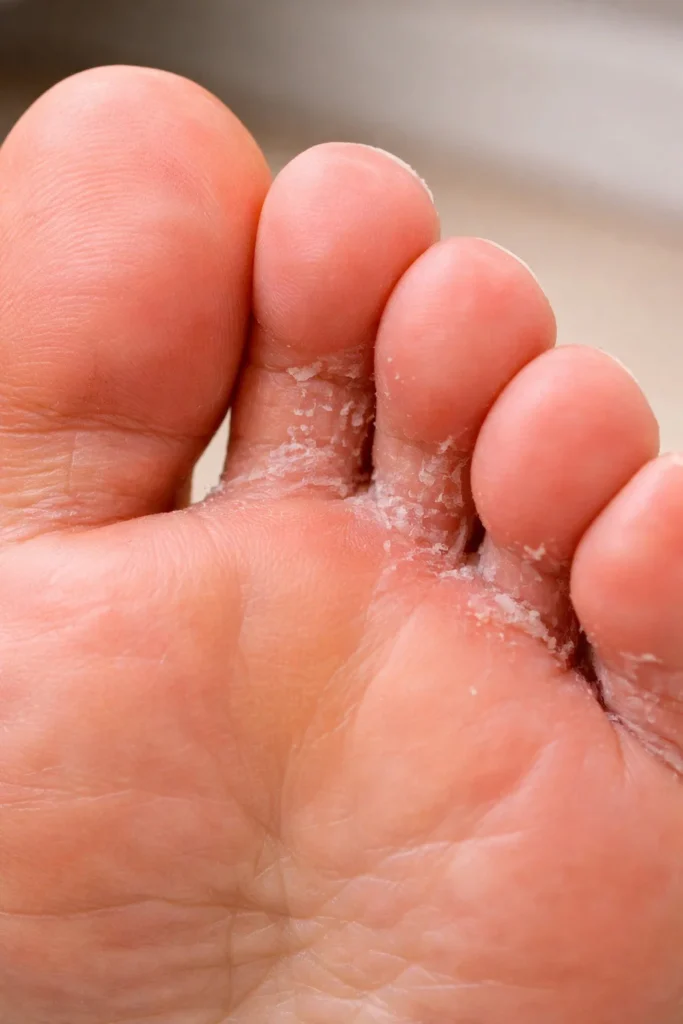 Close-up of toes for foot care and hygiene concept